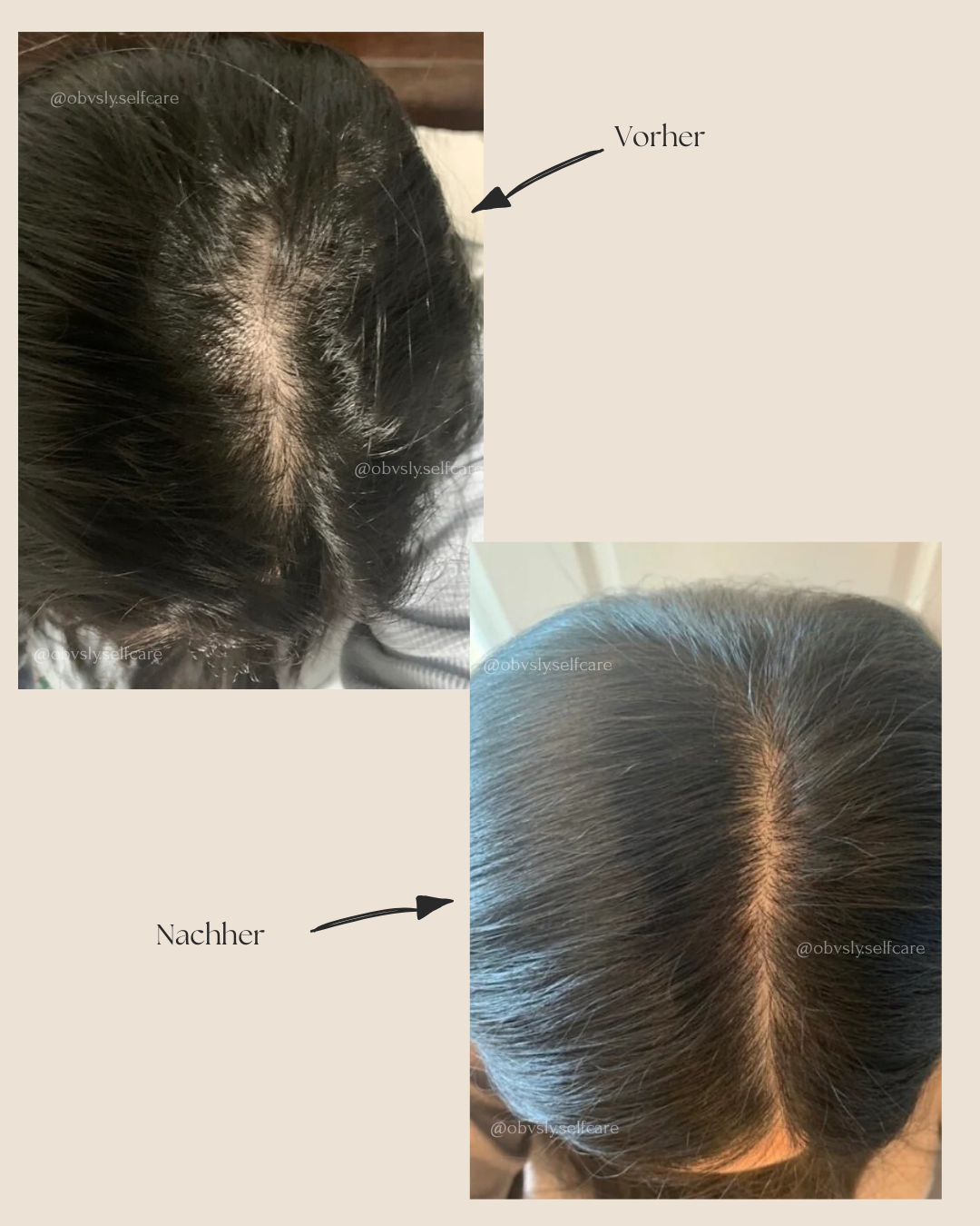 Follicle Boost Oil